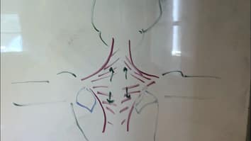 Neck Pain muscle tension