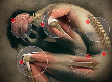 How to Avoid Chronic Pain